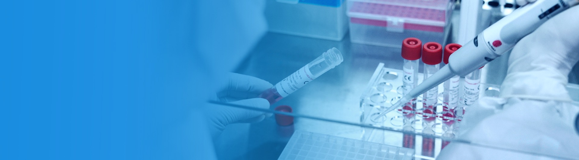 Snelle testkit
