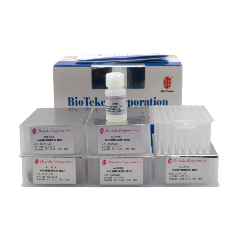 AU17011/17012 Voorverpakte virale DNA RNA -nucleïnezuurextractiekit (magnetische kralen)